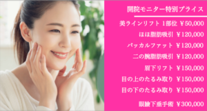モニター情報