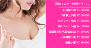 モニター情報